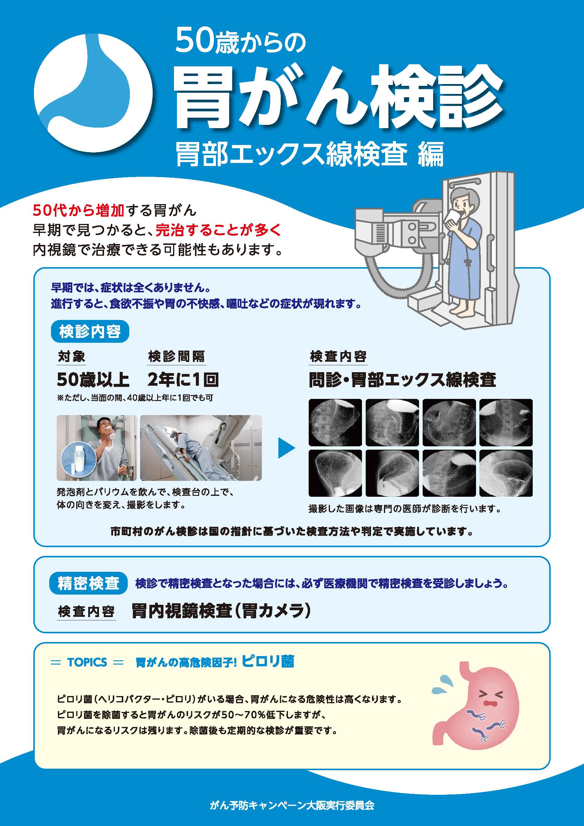 画像：50歳からの胃がん検診　胃部エックス線検査編