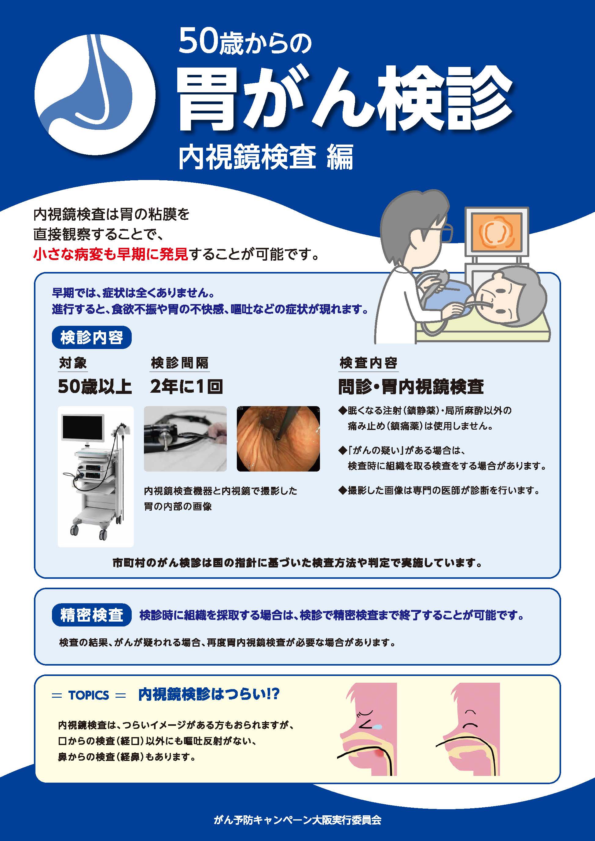 画像：50歳からの胃がん検診　内視鏡検査編