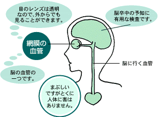 図：網膜や網膜の血管の状態