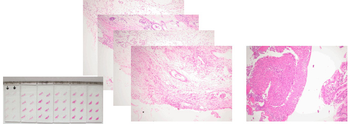 組織検査 画像
