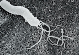 画像：ピロリ菌拡大（電子顕微鏡による）